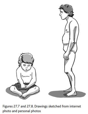 Masochistic character structure, child and adult